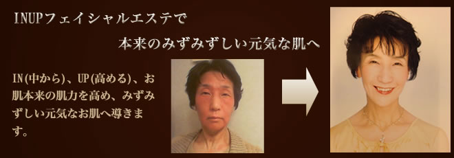 INUPフェイシャル(　ビフォーアフター