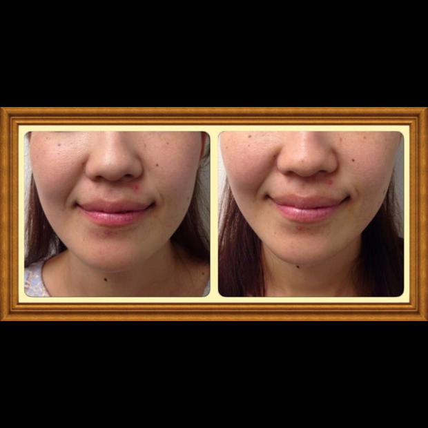 pic20151116053236_1